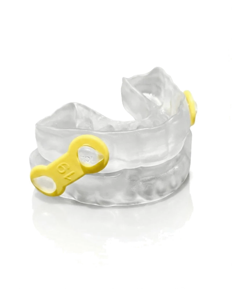 Custom Mandibular Advancement Device for Sleep Apnea — product view